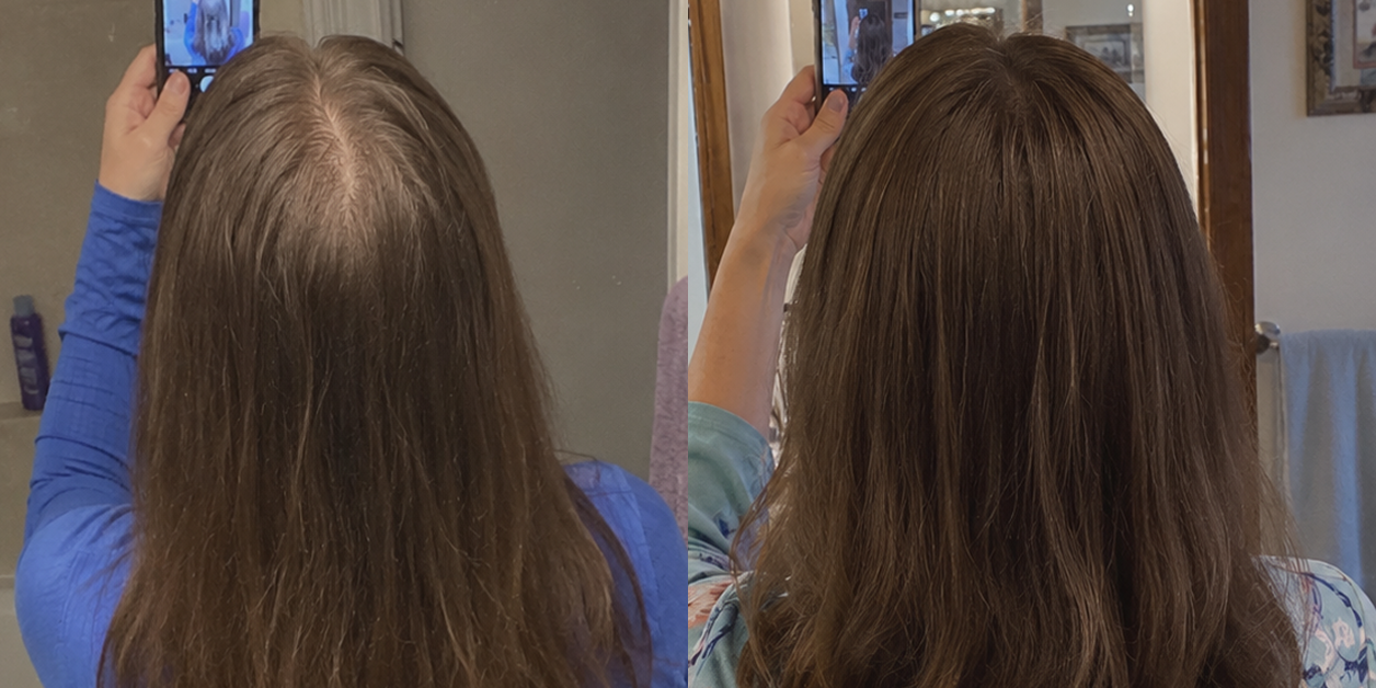 A before and after comparison of a woman's hair, showing increased volume and scalp coverage.