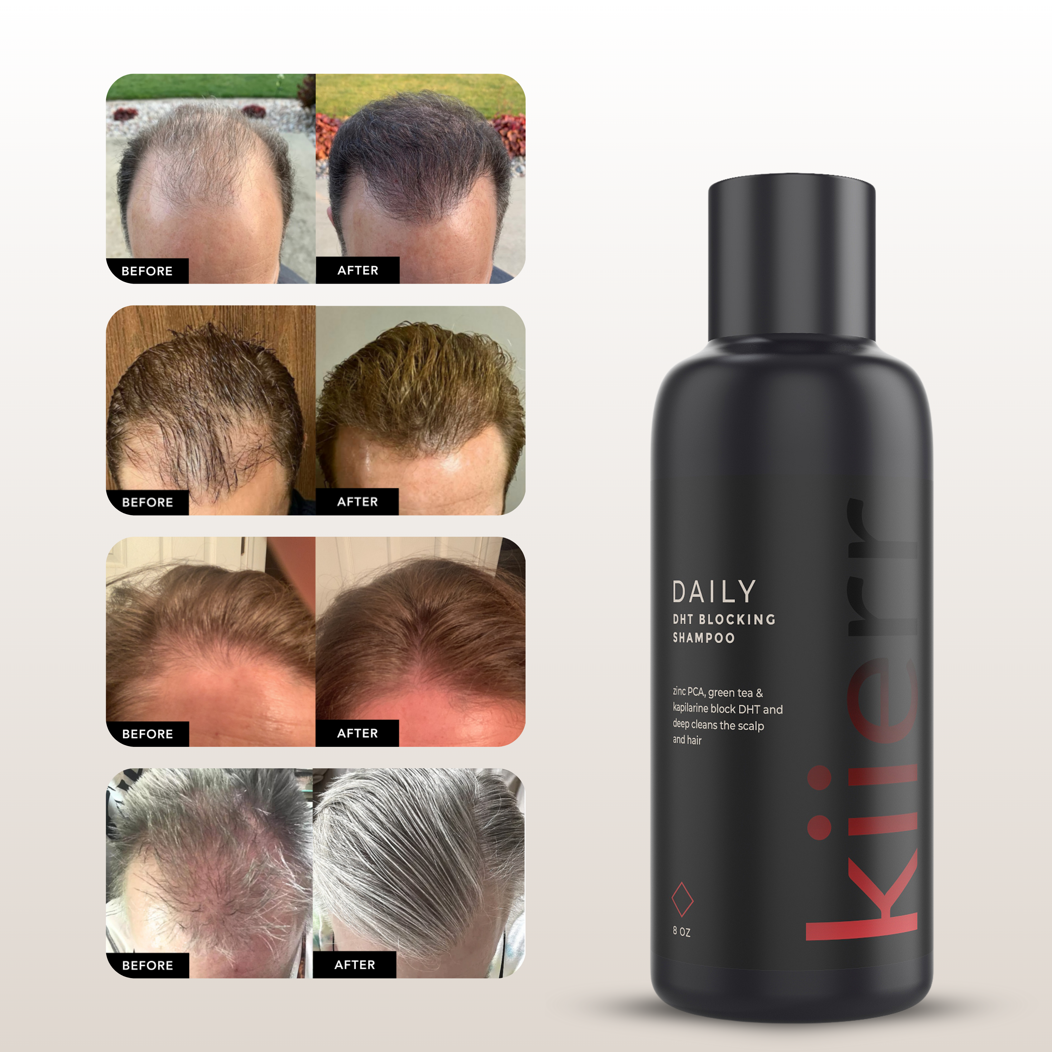 Collage of before and after hair photos with a bottle of shampoo on the right.