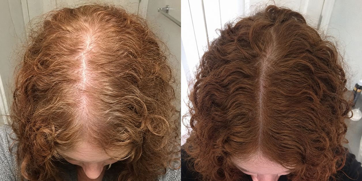 A before and after comparison of a woman's scalp, showing increased hair fullness and a richer color.