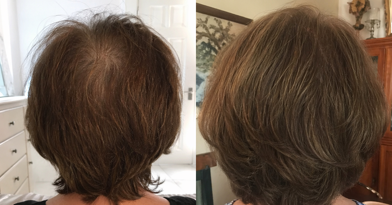 A before-and-after image showing the back of a woman's head, with thinner hair on the left and fuller hair on the right.