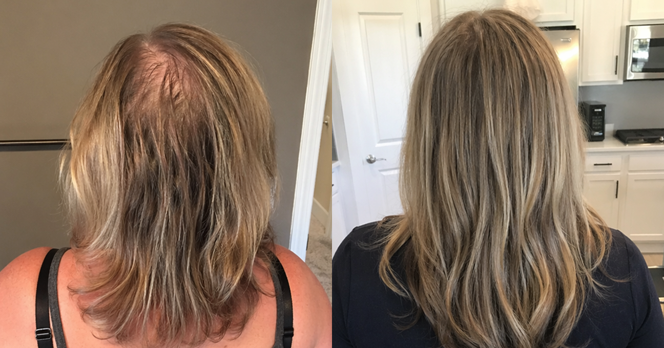 A before and after image showing the back of a woman's head with thinning hair and then fuller hair.