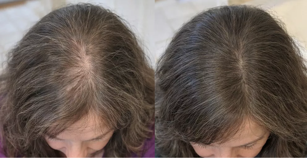 A before and after comparison of the top of a woman's head, with hair looking fuller in the second image.