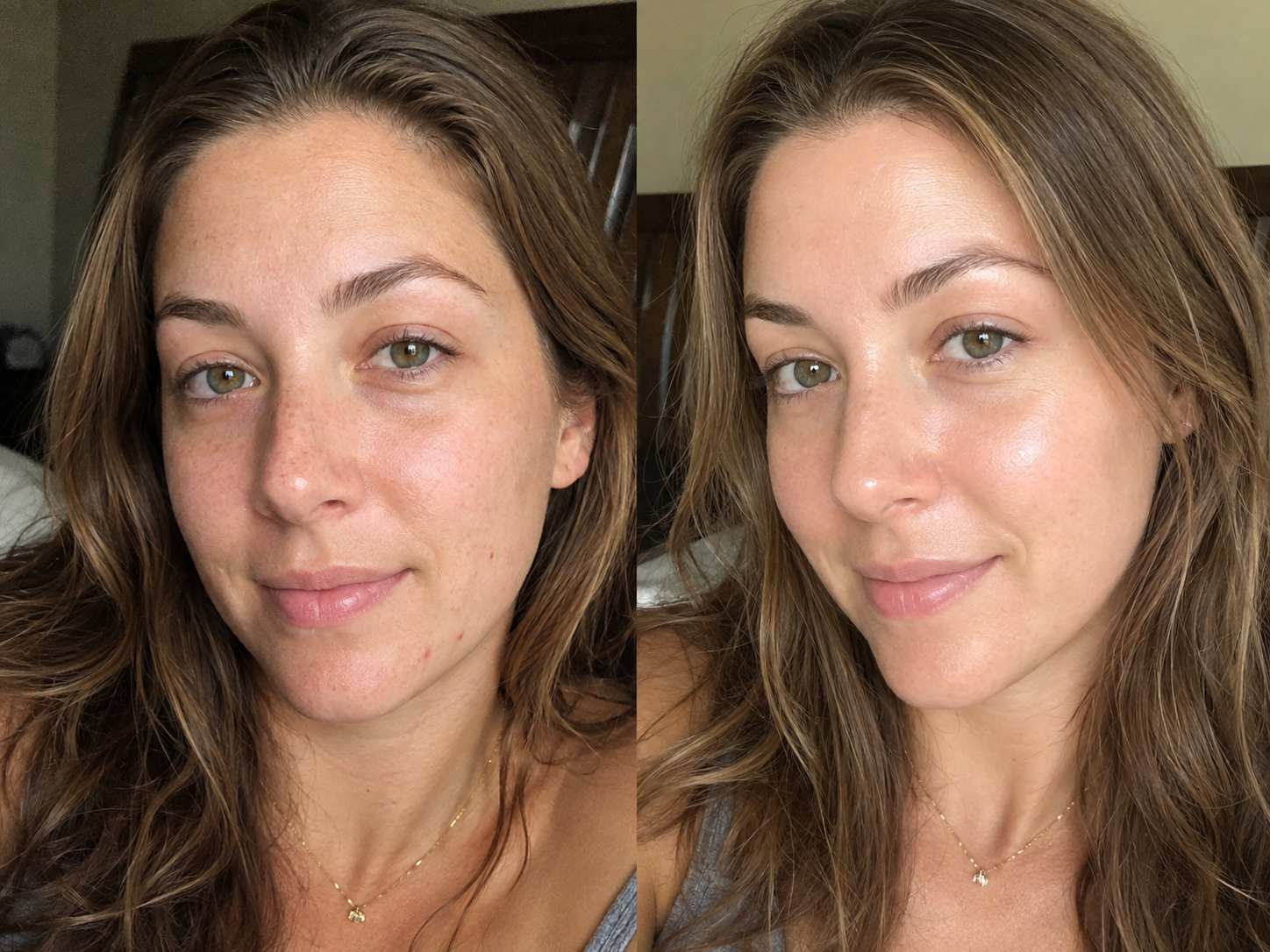 A side-by-side comparison image of a woman's face showing a before and after of her skin.