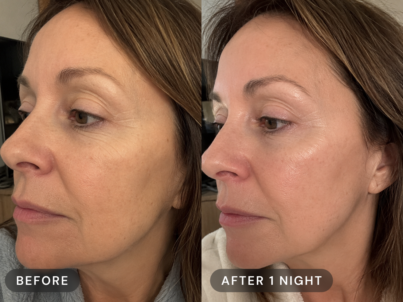 A before-and-after comparison of a woman's face, showing improved skin texture after one night.