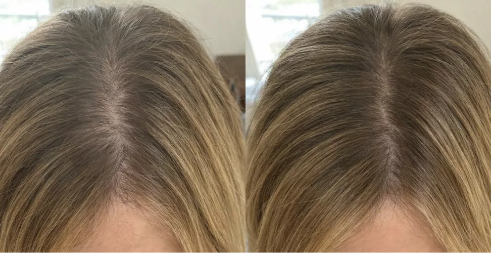 A before-and-after split image showing a close-up of hair roots that have been colored.