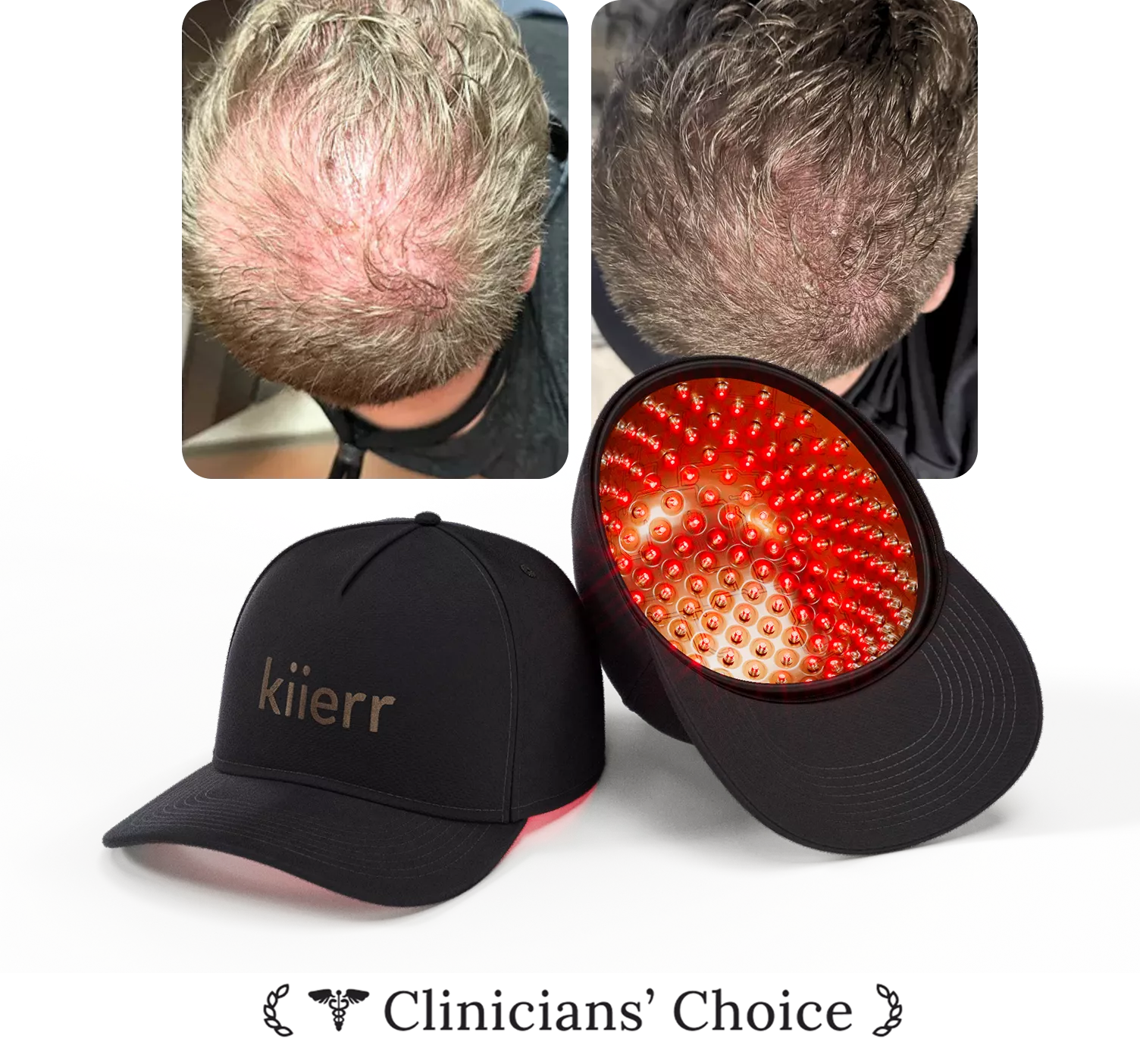 Two images of a man's scalp, two black caps, one with red lights inside.