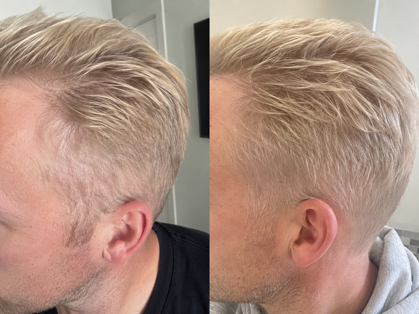 A side-by-side before and after comparison of a man with blonde hair showing increased hair fullness.