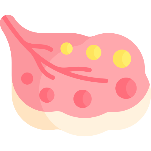 Illustration of a pink pancreas with yellow and red dots.