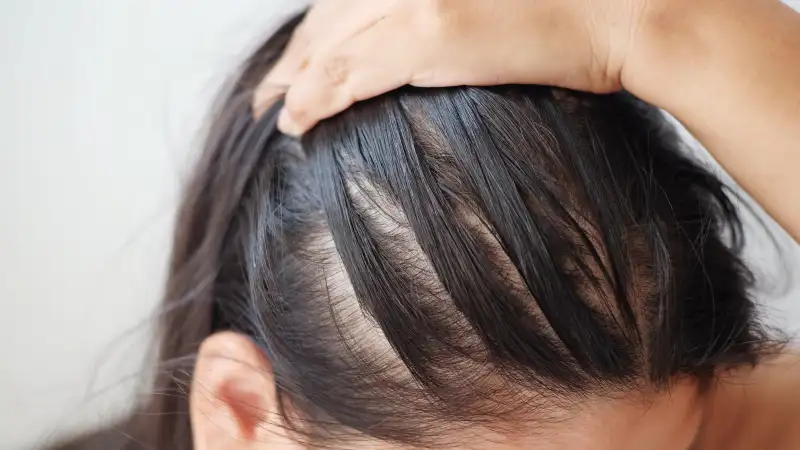 A close-up of a person's hand parting their dark hair, revealing a scalp with thinning hair.