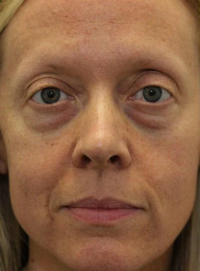 Close-up of a person with light-colored eyes and fair skin, looking directly at the camera.