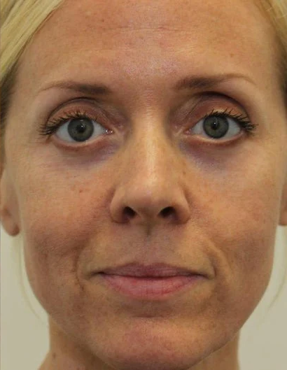 Close-up of a person with a neutral facial expression.