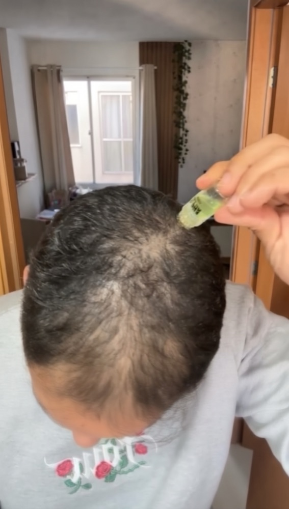 Month 1 results
