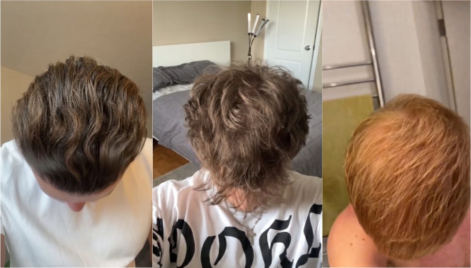 After: the same three men with fuller-looking hair