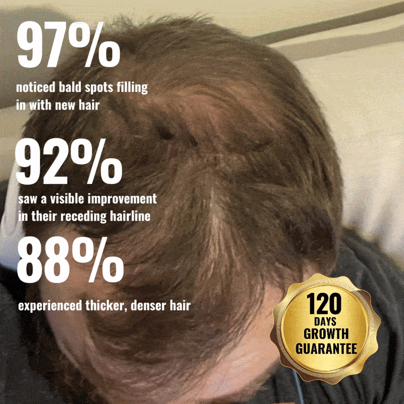 Top view of a person's head with text showing hair regrowth statistics.