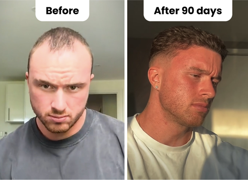 Side-by-side comparison of a man's hair before and after 90 days.