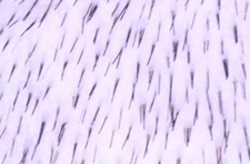 Scalp density DAY 0