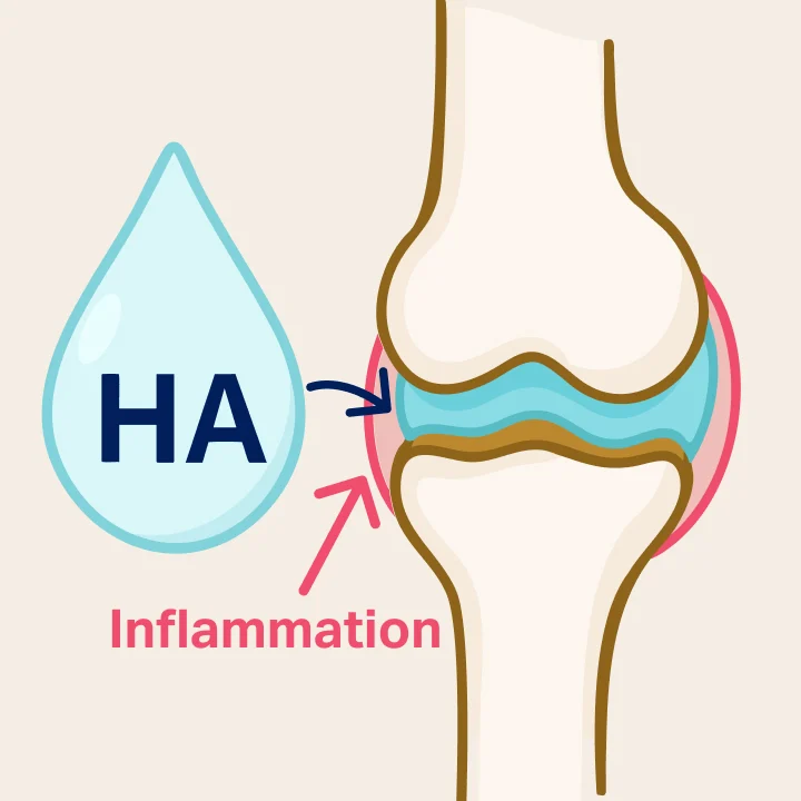 A diagram of a joint showing arrows labeled 'HA' and 'Inflammation' pointing towards the joint capsule.