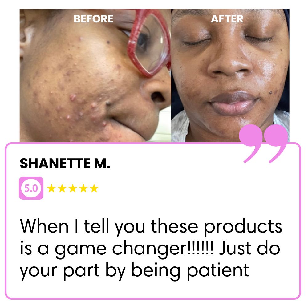 Before and after skincare results with a positive review and five-star rating.
