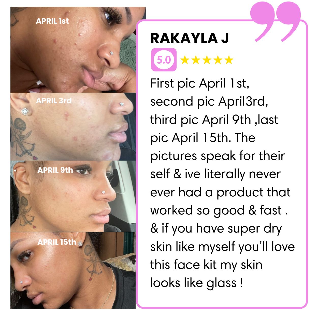 Four side profile images showing skin improvement over time, with accompanying testimonial text.