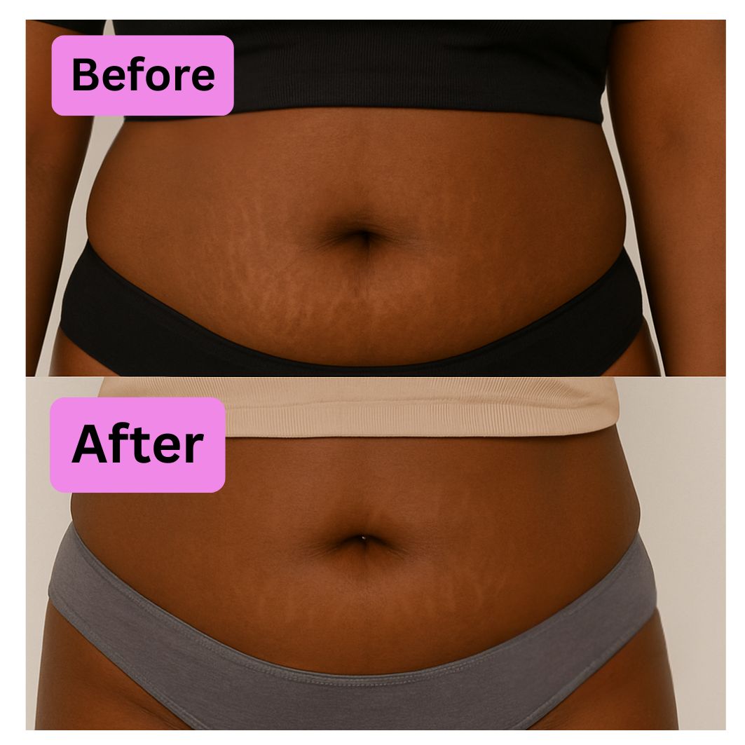 Before and after comparison of a woman's midsection.