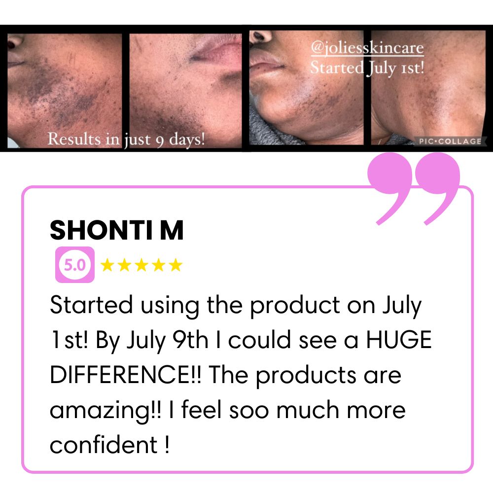 Collage of skin improvement photos and a positive product review with a five-star rating.