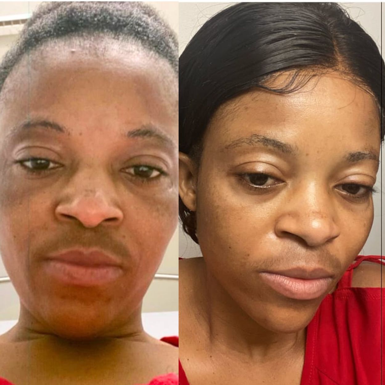 Side-by-side comparison of a person before and after a change.