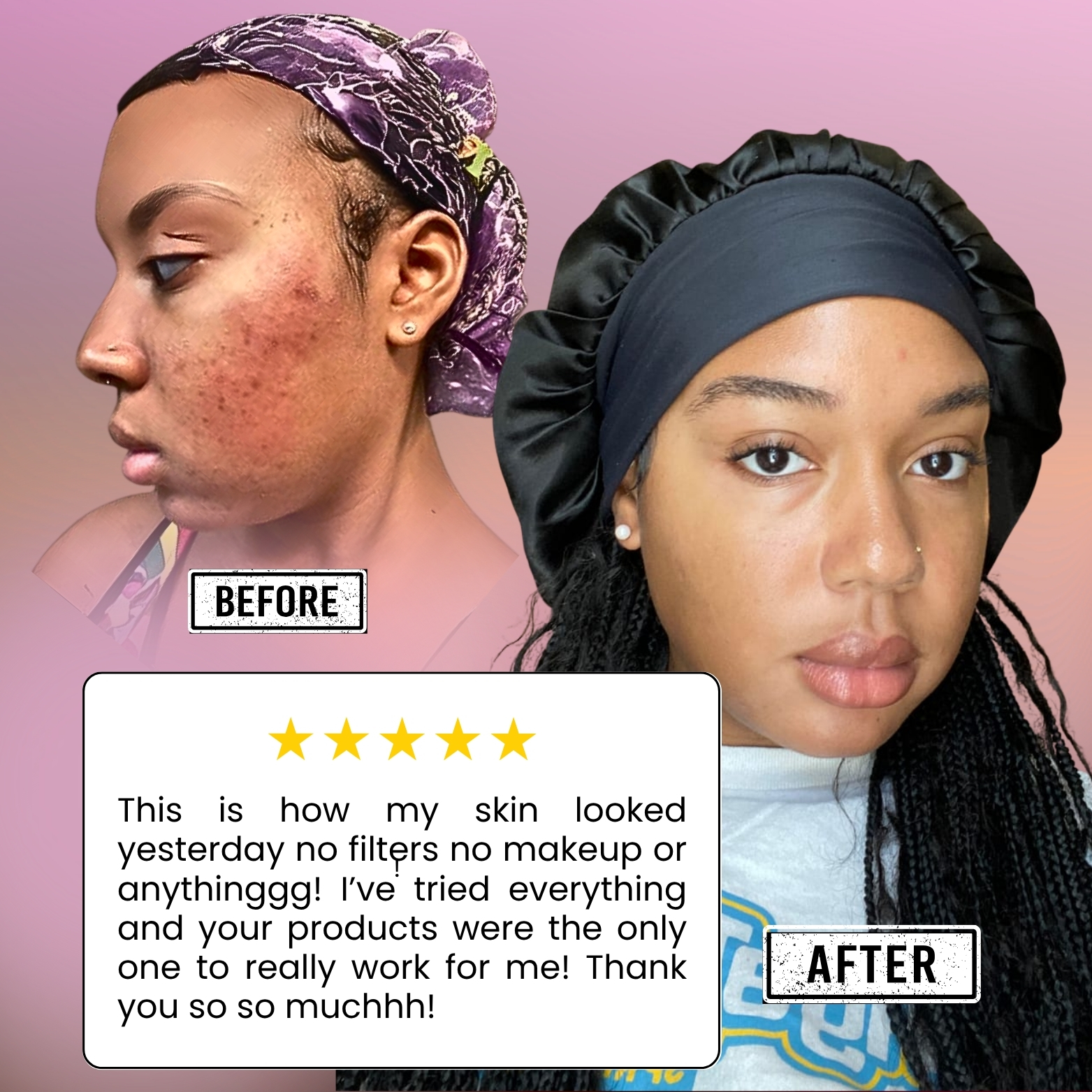 Before and after skincare comparison with a testimonial text.