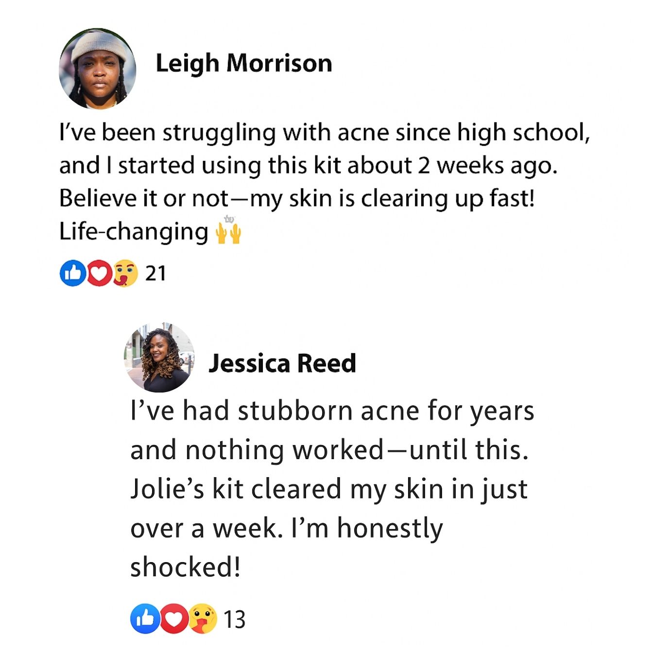 Two testimonials about an acne treatment kit with user photos and reactions.
