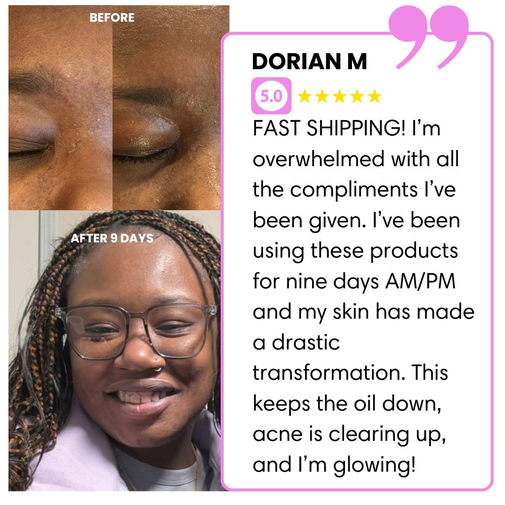 Before and after skincare transformation with a positive review.