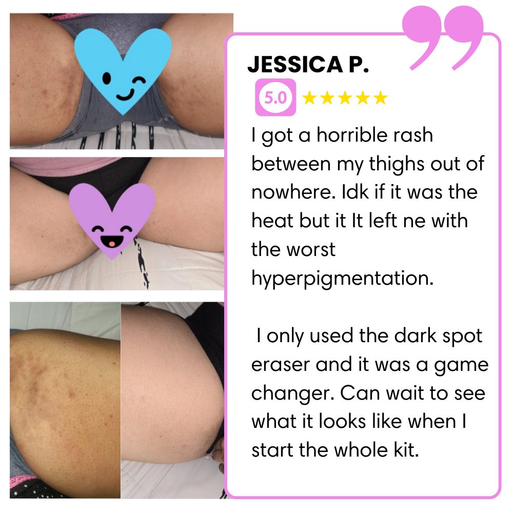 Collage of skin rash images with a testimonial about a dark spot eraser product.