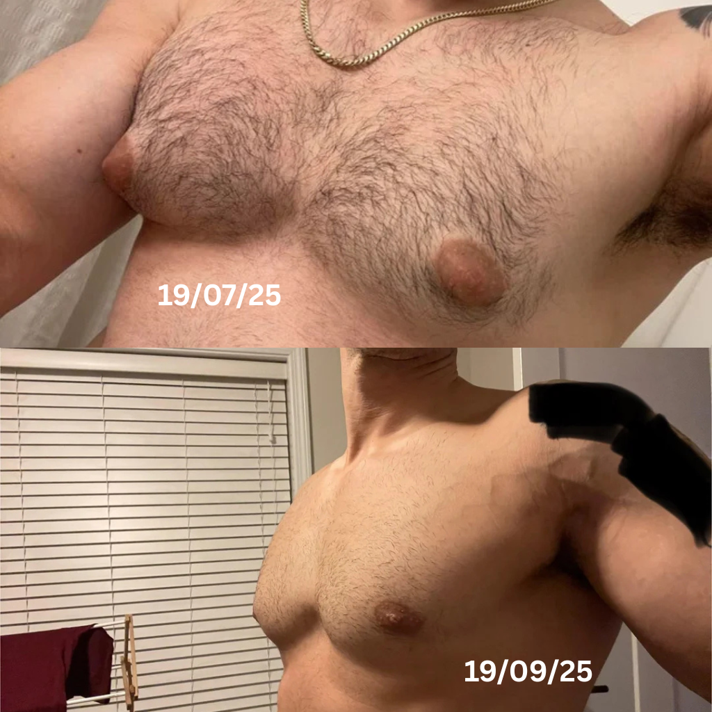 Two photos comparing a man's chest, dated July and September 2019.