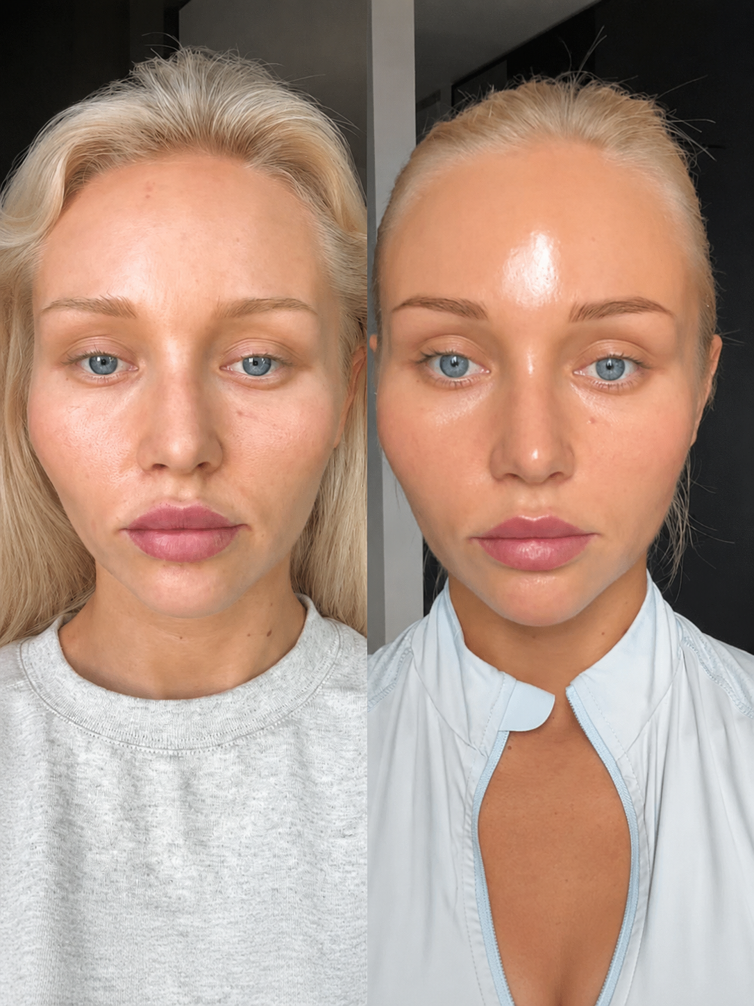 A side-by-side comparison of a woman's face, showing a change in skin texture and facial fullness.
