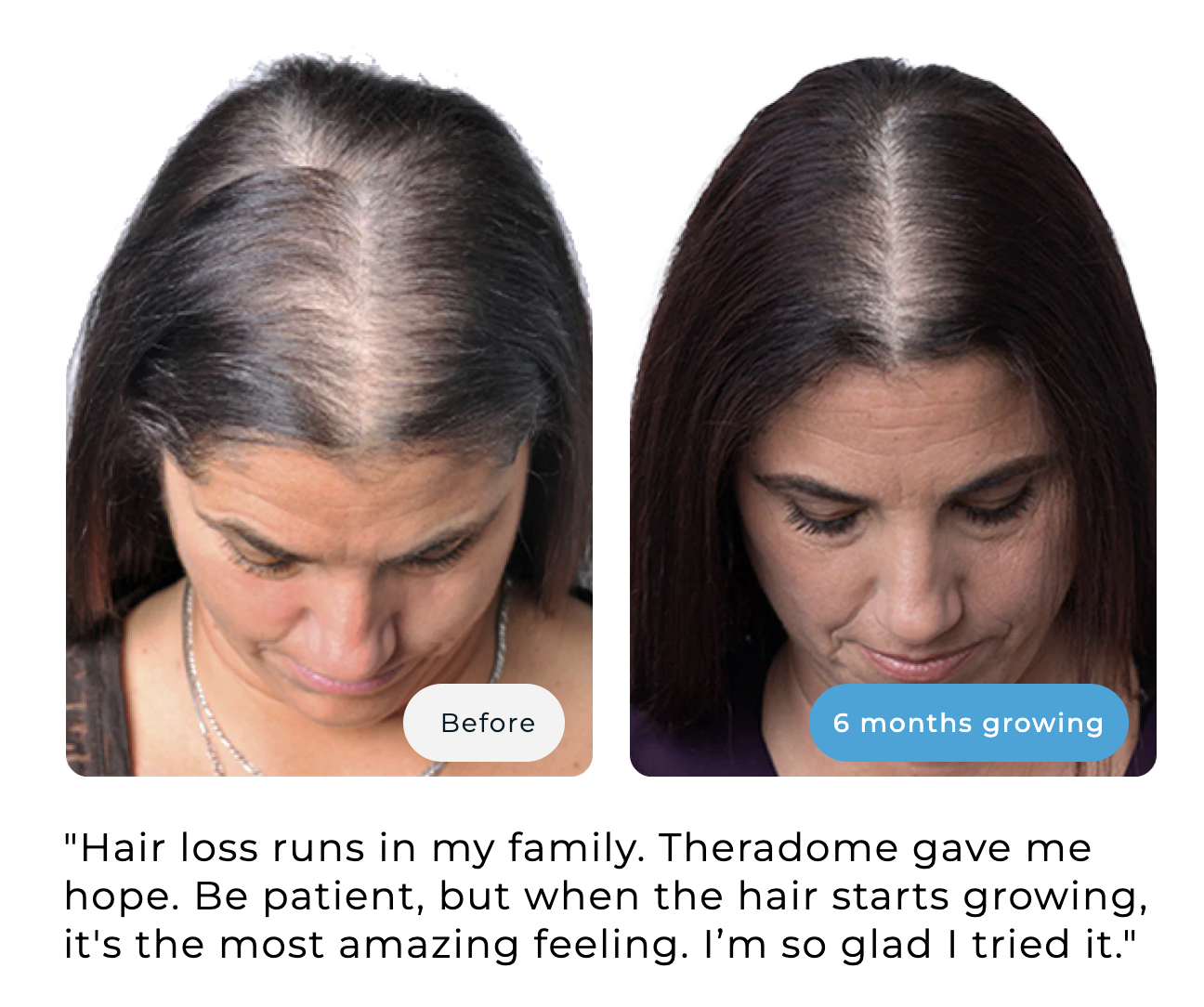 Before and after images showing hair growth over six months.