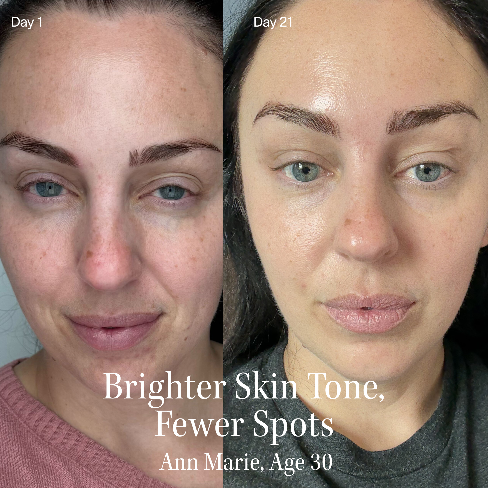 Side-by-side comparison of a woman's face on Day 1 and Day 21.