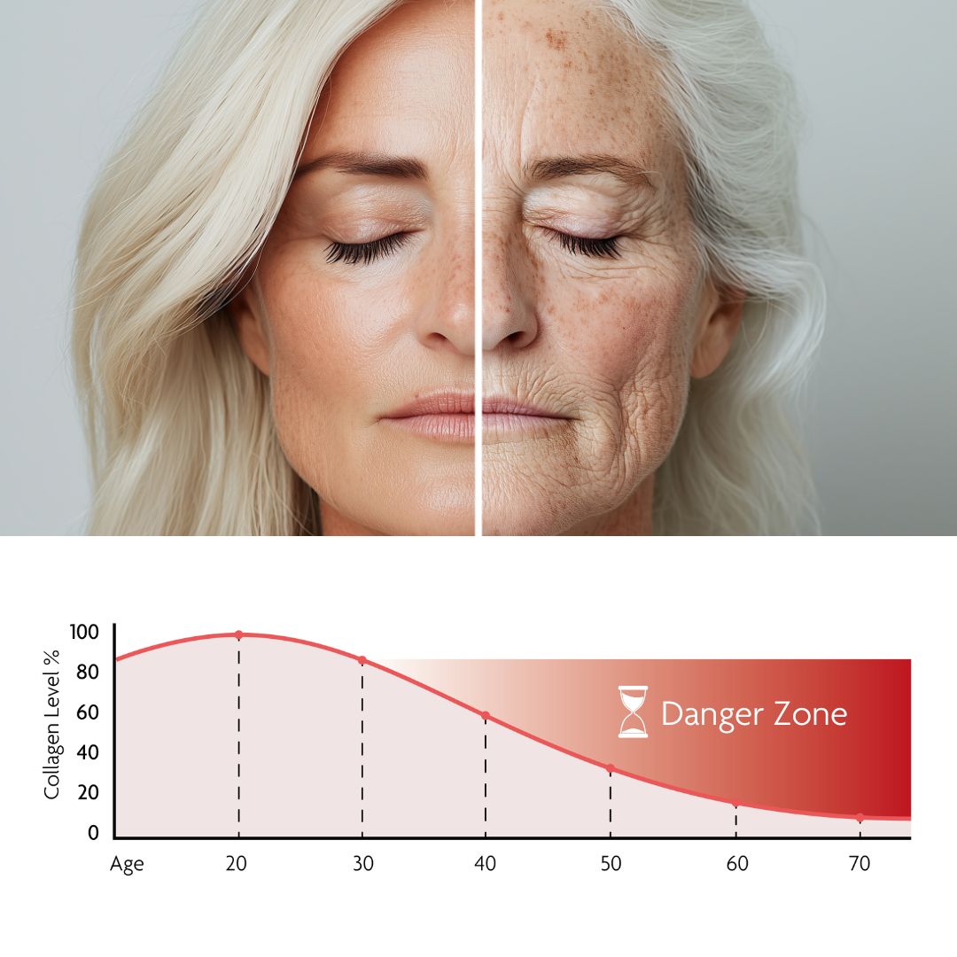 Split image of a woman's face, young and aged, with collagen level graph below.