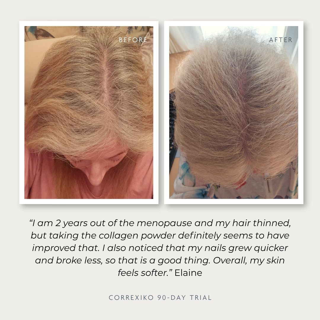 Before and after images showing hair improvement on a woman's scalp.