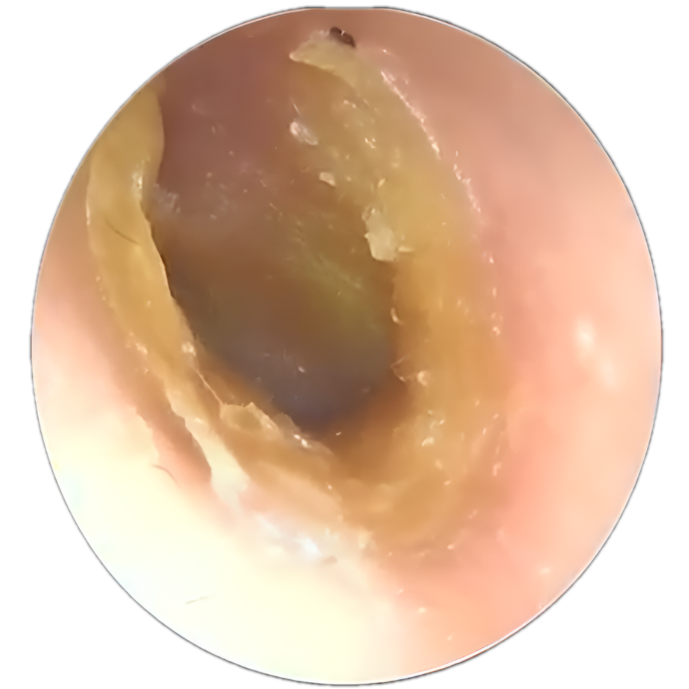 6 Types of Ear Itch and What Each Means | Slivor