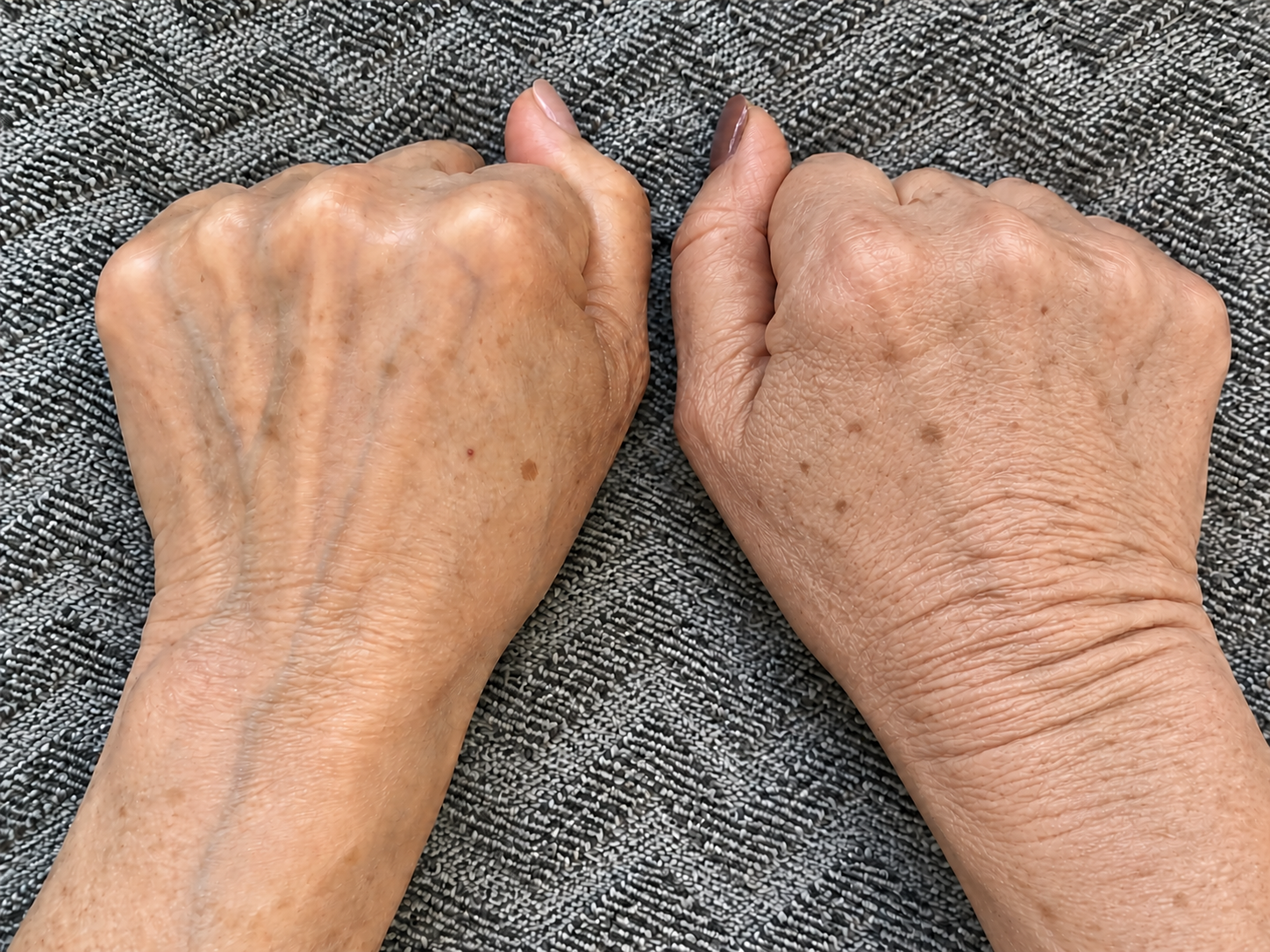 Even her hands looked younger.