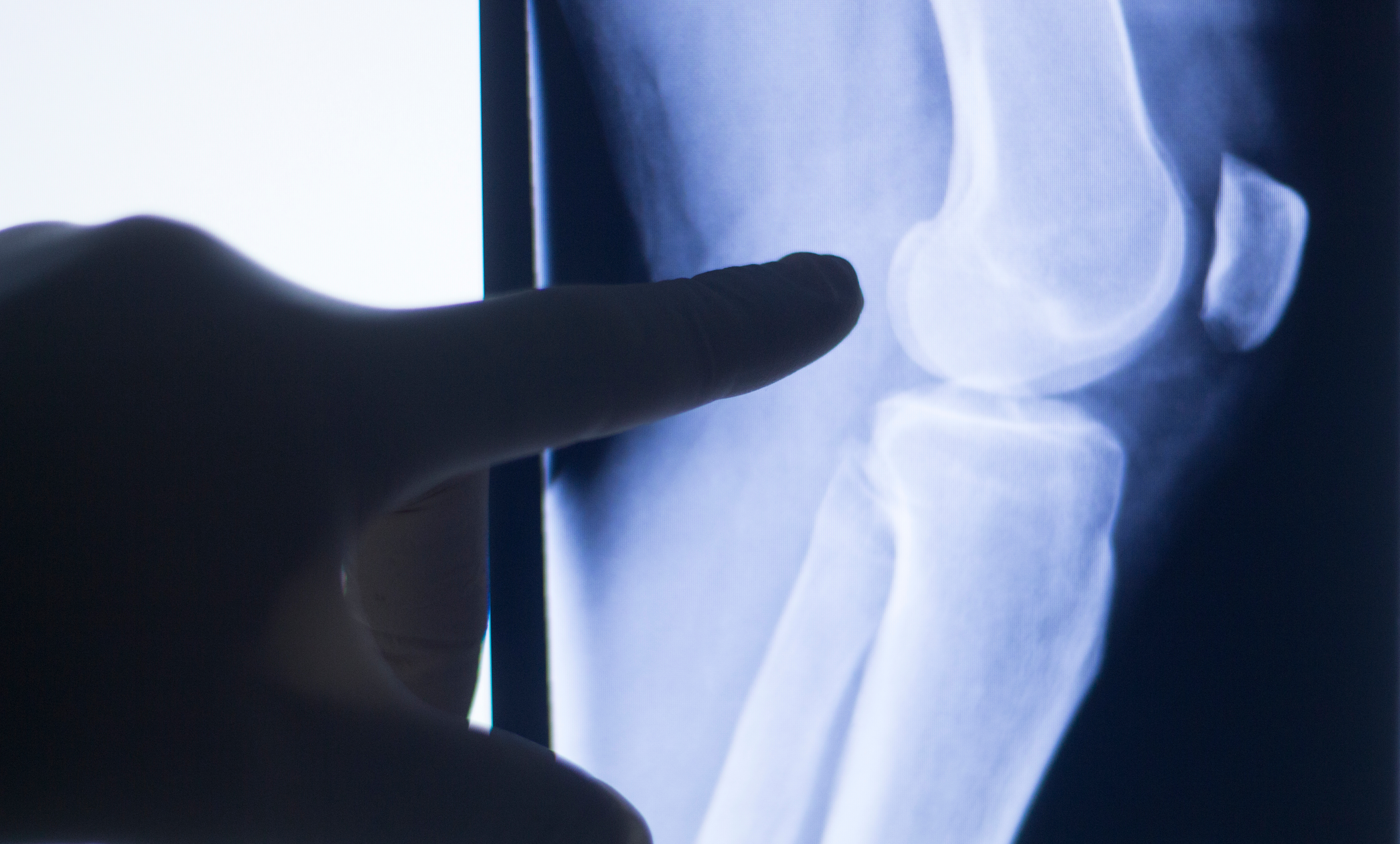 Person holding knee with glowing red area, indicating pain.