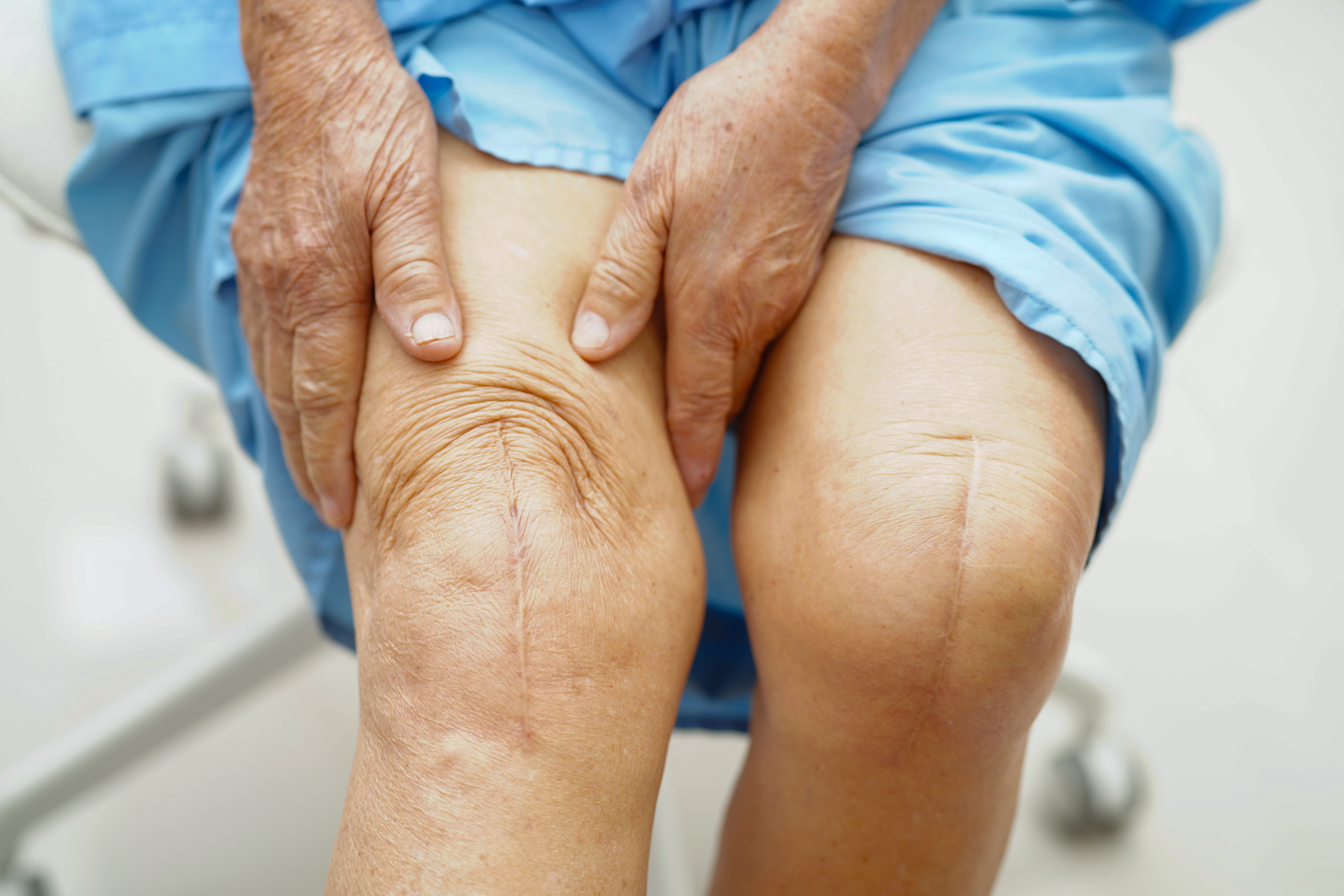 Medical illustration of skeletal pain points highlighted in red.