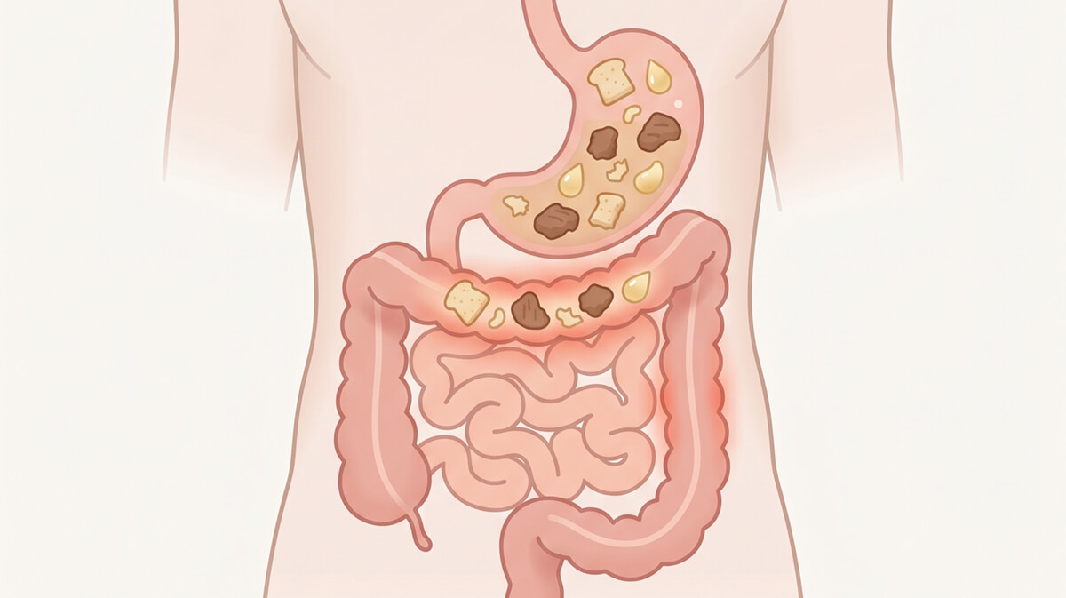 An anatomical illustration of the human digestive system, showing food passing through the stomach and intestines.