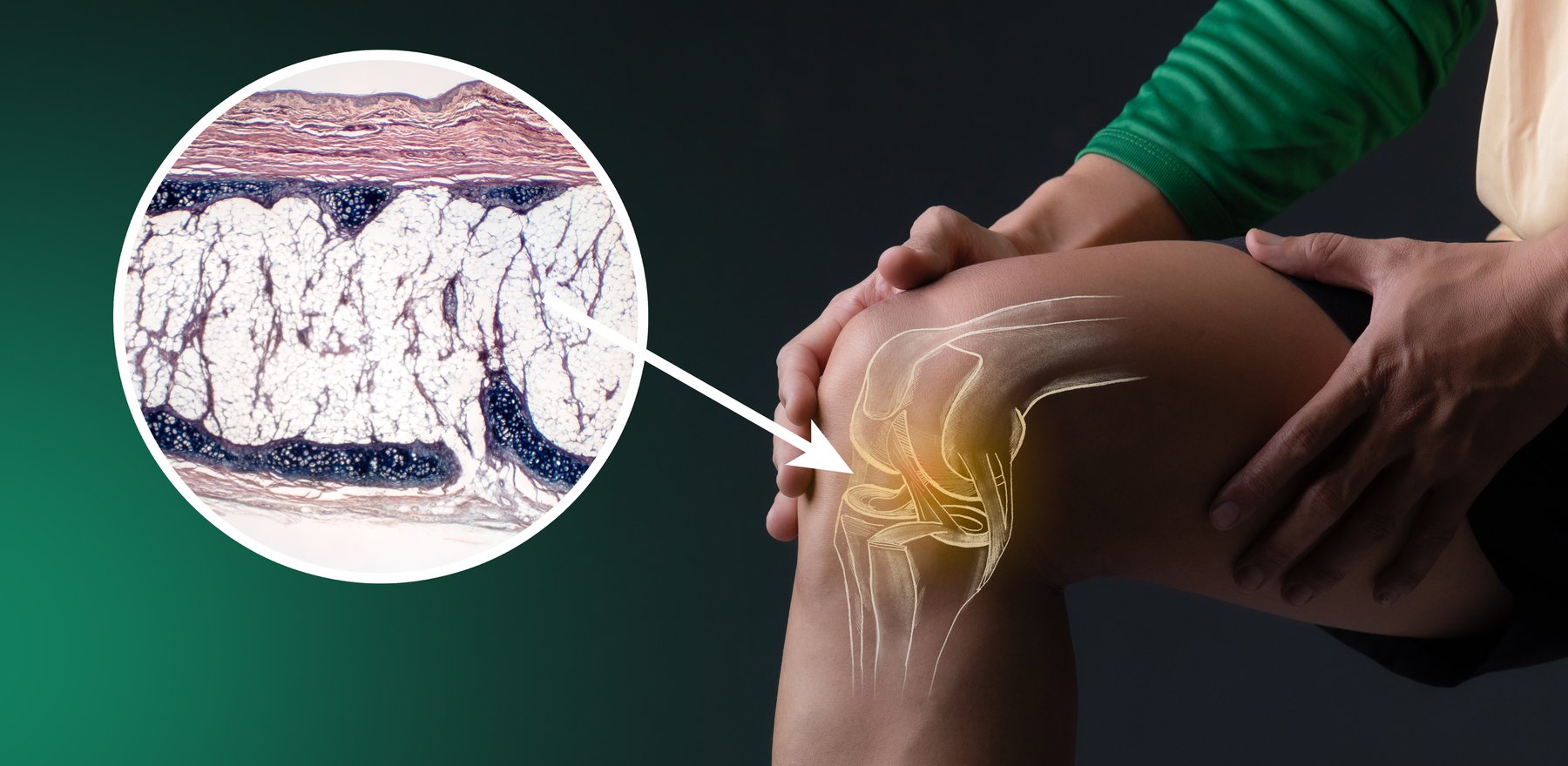 Close-up of a knee with a cutaway view showing joint structure and tissues.