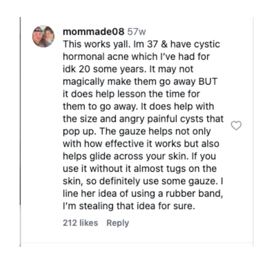 A screenshot of a positive user review for a product that helps with cystic hormonal acne.