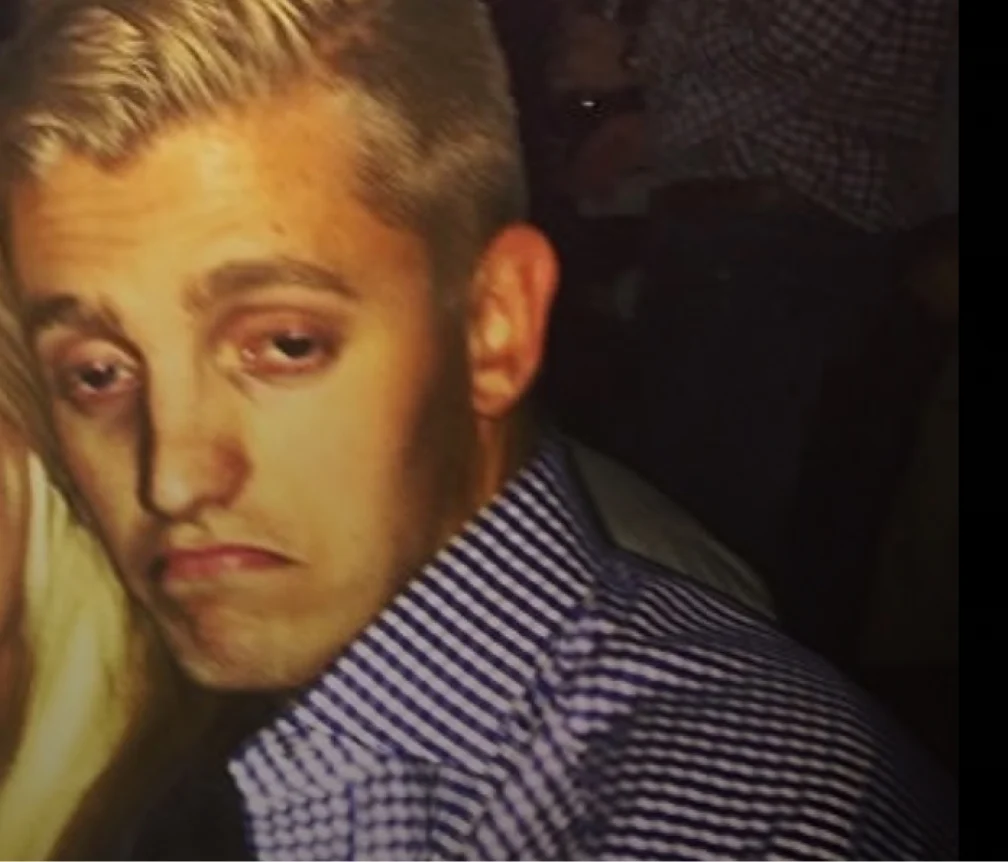 A young man with blonde hair and a weary expression wearing a striped button-down shirt.