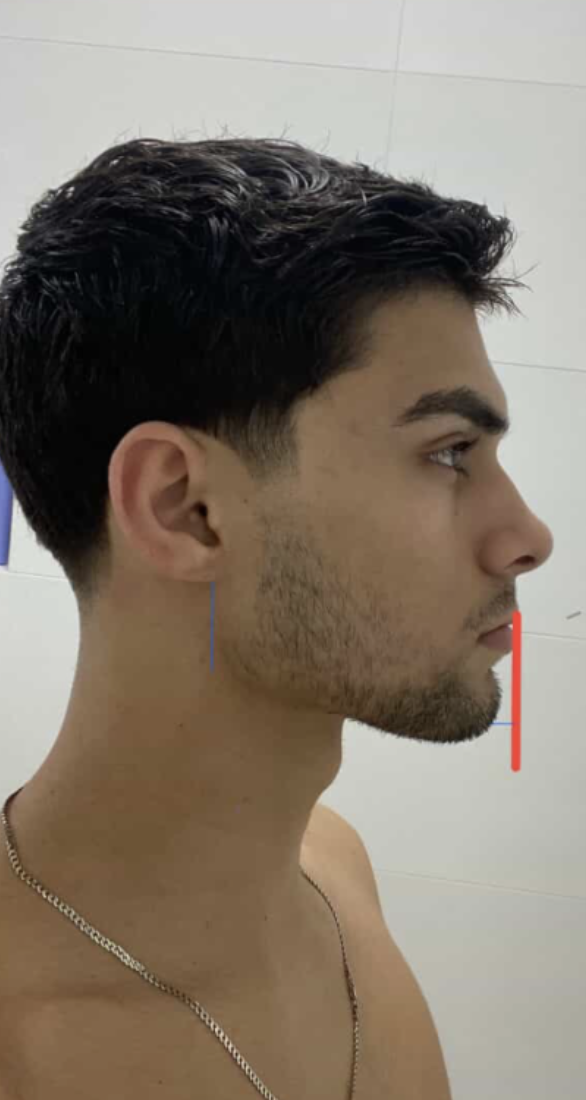 A profile view of a young man with dark hair, with red and blue lines drawn on his face.