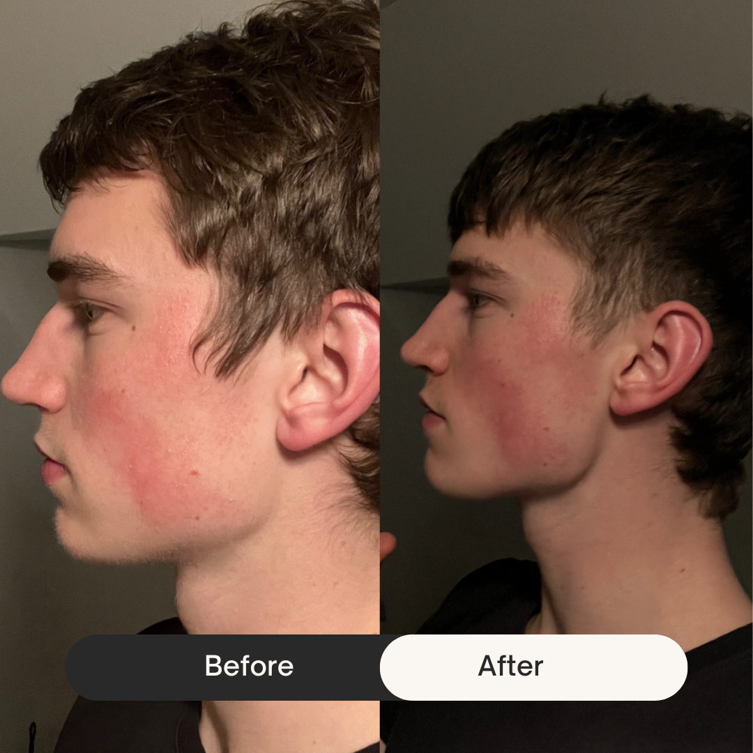 Side-by-side before and after profiles of a person.