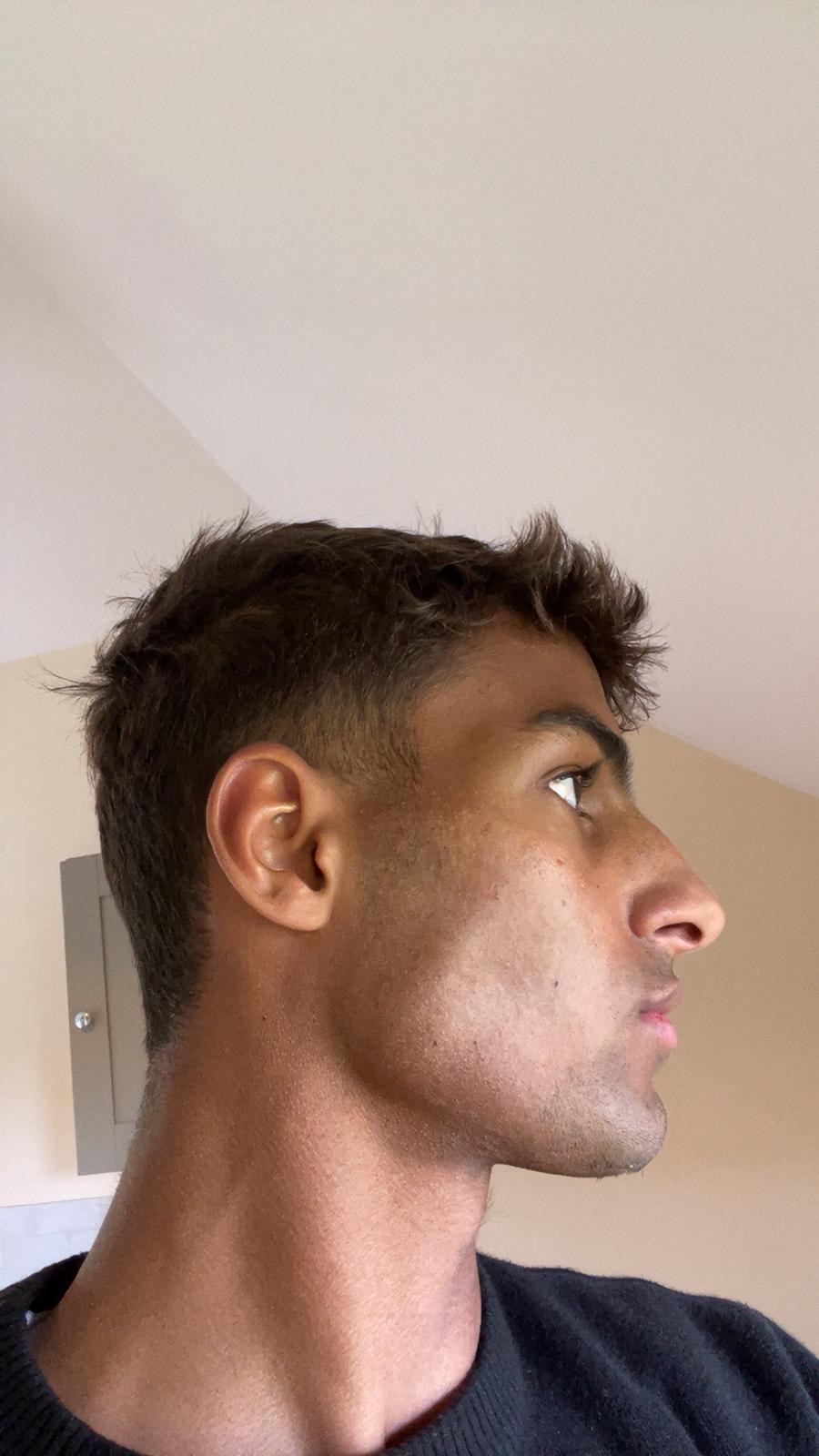 Side profile of a person looking to the right.