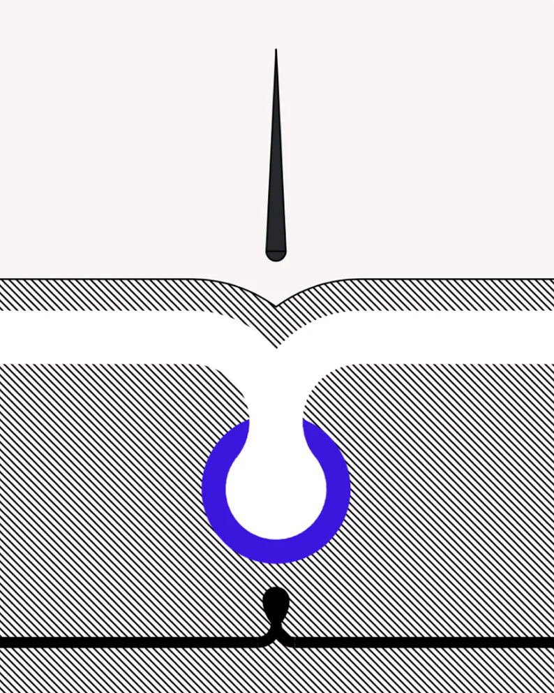 A minimalist diagram of a cross-section of a hair follicle with a needle pointed towards it.