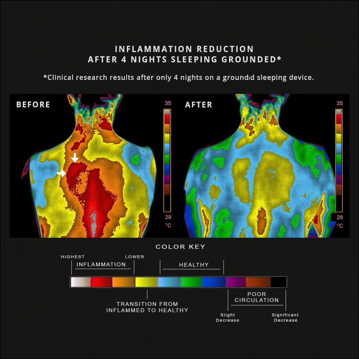 Before and after thermal images of a person's back, showing a reduction in areas of high temperature.