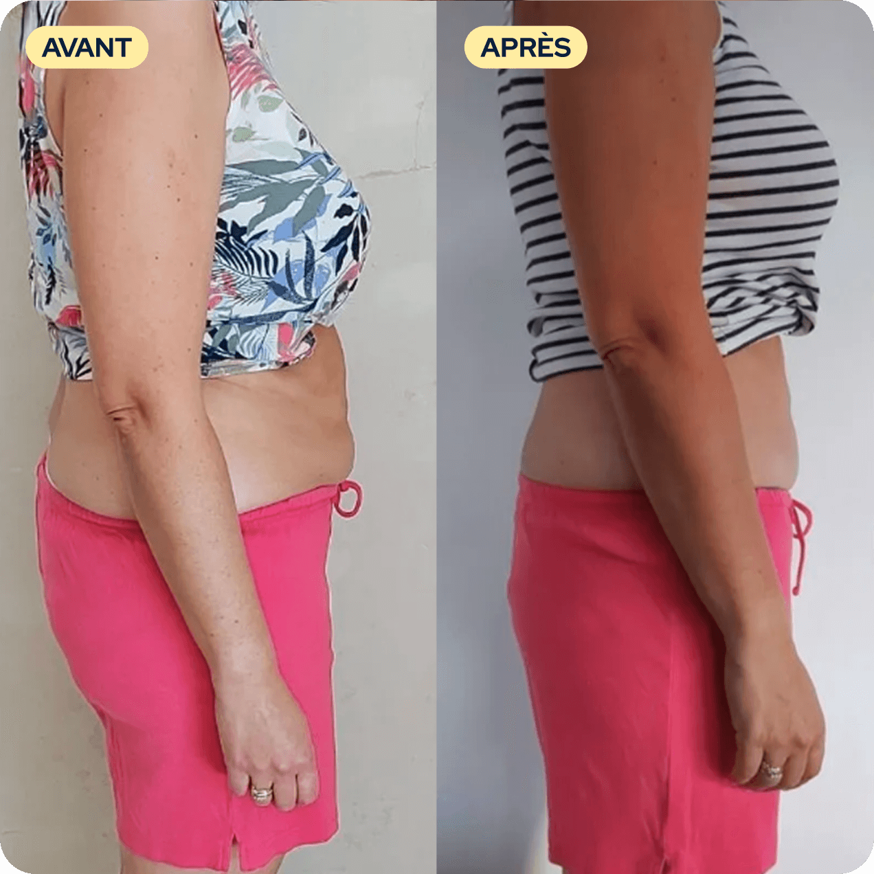 A before and after image showing a side profile of a woman's torso with a visible change.